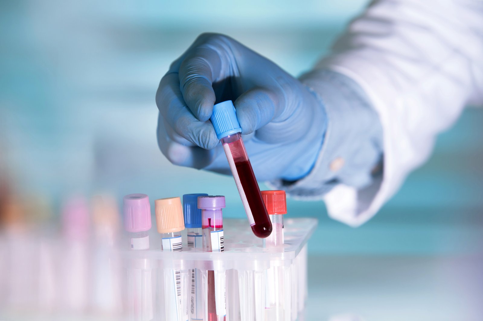 First Choice Diagnostic home blood sample collection service in Navi Mumbai